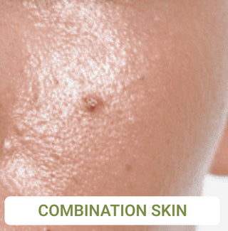 Combination Skin