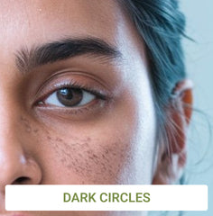 Dark Circles